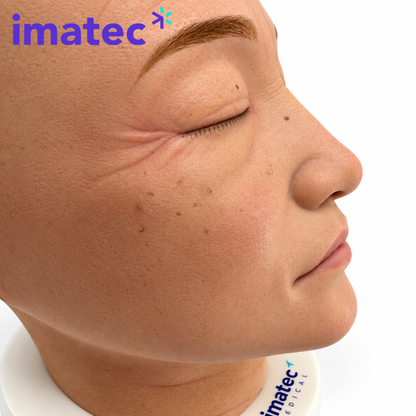 Full-Head Facial Injection Simulator by Imatec Medical
