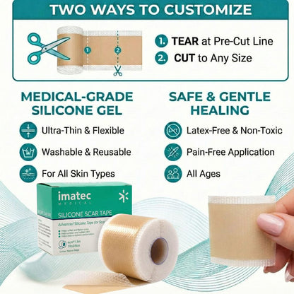 Silicone Scar Tape (4cm x 1.5m) Natural Beige by Imatec Medical
