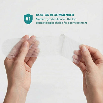 Restore Silicone Scar Sheet (150mmx15mm) by Imatec Medical